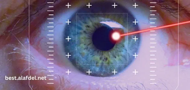 An image with an eye directed by a laser beam to treat vision problems and clarify the applications of lasers in ophthalmology.