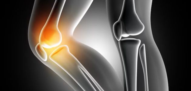 joint leg inflammation may cause rheumatoid arthritis 