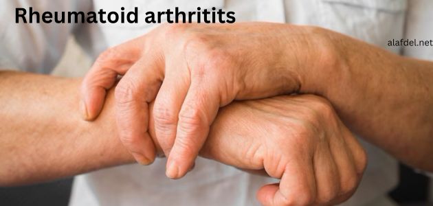 both hands of man which suffering from rheumatoid arthritits